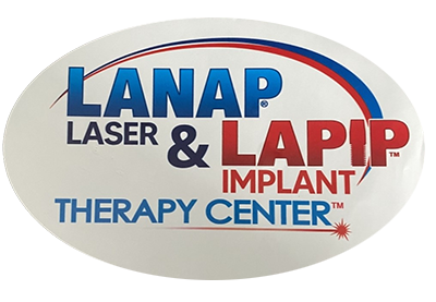 Lanapn Laser